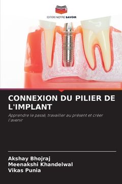 portada Connexion Du Pilier de l'Implant (en Francés)