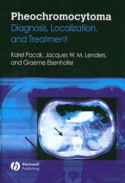 portada Pheochromocytoma: Diagnosis, Localization, and Treatment (en Inglés)