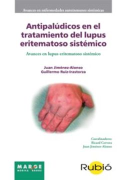 portada Antipaludicos En El Tratamiento Del Lupus Eritematoso Sistemico