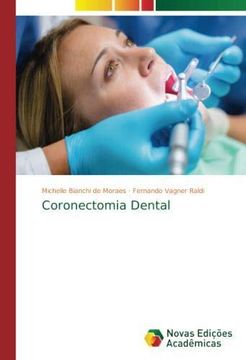 portada Coronectomia Dental (Paperback) (in Portuguese)