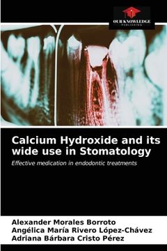 portada Calcium Hydroxide and its wide use in Stomatology (in English)