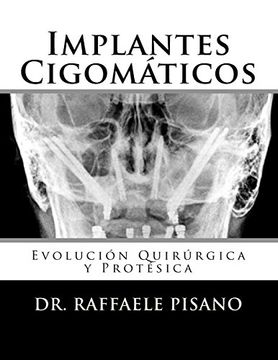 portada Implantes Cigomáticos: Evolución Quirúrgica y Protésica