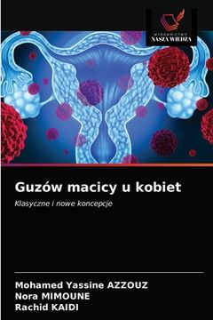 portada Guzów macicy u kobiet (in Polaco)