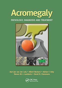 portada Acromegaly: Pathology, Diagnosis and Treatment (in English)