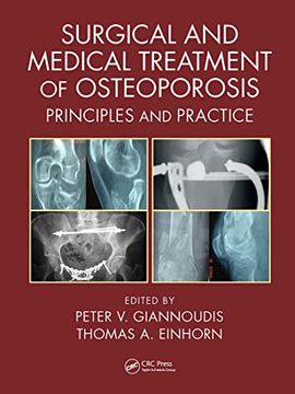 portada Surgical and Medical Treatment of Osteoporosis: Principles and Practice 