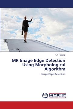 portada MR Image Edge Detection Using Morphological Algorithm (en Inglés)
