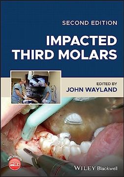 portada Impacted Third Molars (en Inglés)