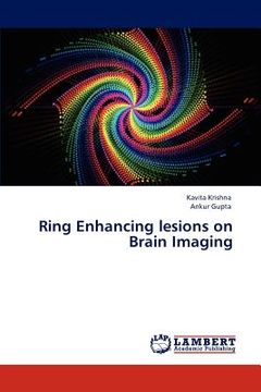 portada ring enhancing lesions on brain imaging
