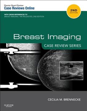 portada breast imaging