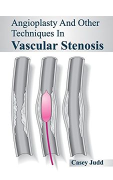 portada Angioplasty and Other Techniques in Vascular Stenosis 