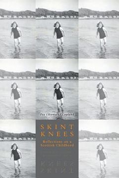 portada Skint Knees: Reflections on a Scottish Childhood (en Inglés)