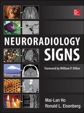portada Neuroradiology Signs (en Inglés)