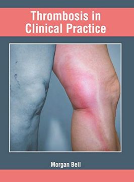 portada Thrombosis in Clinical Practice (en Inglés)
