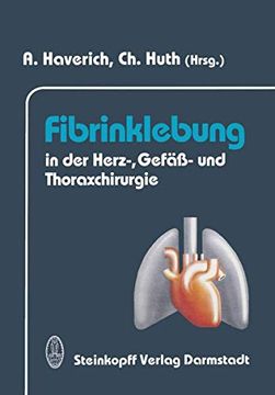 portada Fibrinklebung in der Herz-, Gefäß- und Thoraxchirurgie (en Alemán)