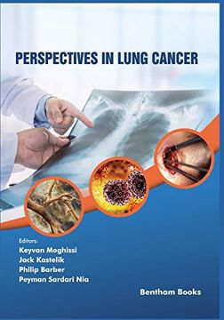 portada Perspectives in Lung Cancer: 1 (Frontiers in Lung Cancer) 