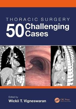 portada Thoracic Surgery: 50 Challenging Cases (en Inglés)