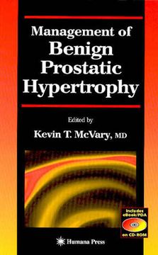 portada management of benign prostatic hypertrophy