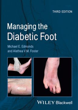 portada Managing The Diabetic Foot, 3Rd Edition