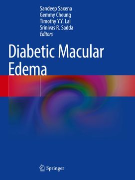 portada Diabetic Macular Edema (en Inglés)
