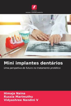portada Mini Implantes Dentários
