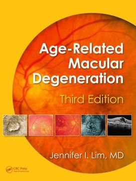portada Age-Related Macular Degeneration, Third Edition (en Inglés)