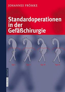 portada Standardoperationen in der Gefäßchirurgie (en Alemán)