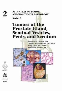 portada Tumors of the Prostate Gland, Seminal Vesicles, Penis, and Scrotum (Afip Atlas of Tumor and Non-Tumor Pathology, Series 5) (en Inglés)