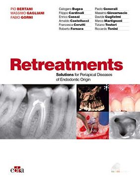 portada Retreatments. Solutions for Periapical Diseases of Endodontic Origin (in English)