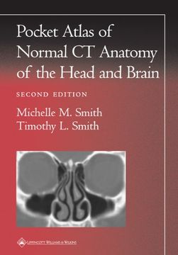 portada Pocket Atlas of Normal ct Anatomy of the Head and Brain (Radiology Pocket Atlas Series) (en Inglés)