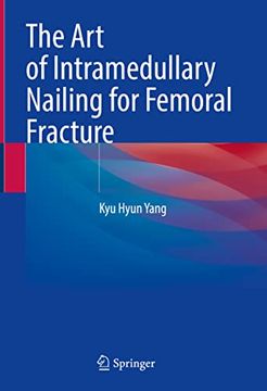 portada The Art of Intramedullary Nailing for Femoral Fracture (en Inglés)