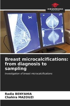 portada Breast microcalcifications: from diagnosis to sampling (en Inglés)