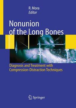 portada Nonunion of the Long Bones: Diagnosis and Treatment with Compression-Distraction Techniques (in English)
