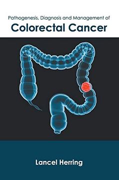 portada Pathogenesis, Diagnosis and Management of Colorectal Cancer (en Inglés)