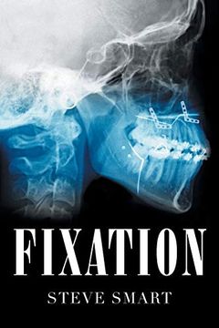 portada Fixation 