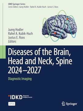 portada Diseases of the Brain, Head and Neck, Spine 2024-2027: Diagnostic Imaging (en Inglés)