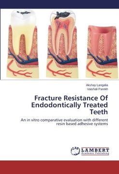 portada Fracture Resistance of Endodontically Treated Teeth