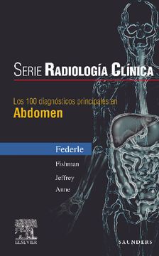 portada Serie Radiología Clínica: Los 100 Diagnósticos Principales en Abdomen (Serie Pocket de Radiologia) (in Spanish)