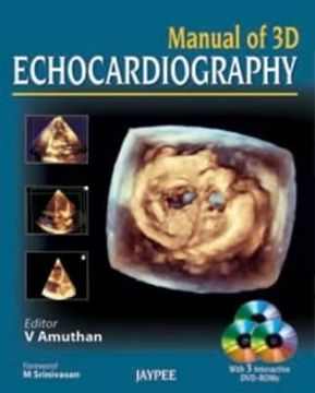 portada manual of 3d echocardiography (en Inglés)