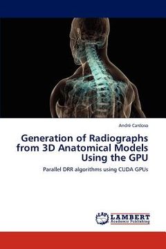 portada generation of radiographs from 3d anatomical models using the gpu (en Inglés)