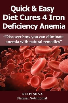 portada Anemia: Iron Deficiency Diet: Large Print: Quick and Easy Diet Cures For Anemia (en Inglés)