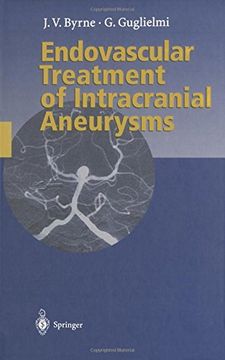 portada endovascular treatment of intracranial aneurysms (en Inglés)