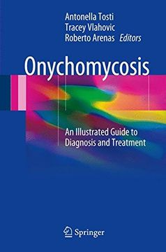 portada Onychomycosis: An Illustrated Guide to Diagnosis and Treatment