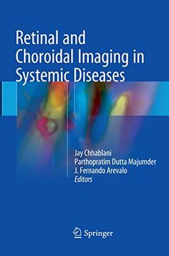 portada Retinal and Choroidal Imaging in Systemic Diseases (en Inglés)