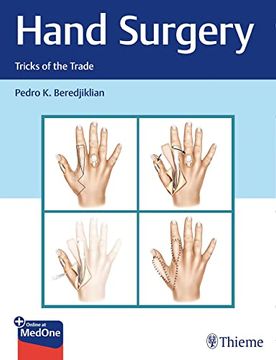 portada Hand Surgery: Tricks of the Trade (en Inglés)