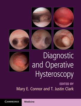 portada Diagnostic and Operative Hysteroscopy (en Inglés)
