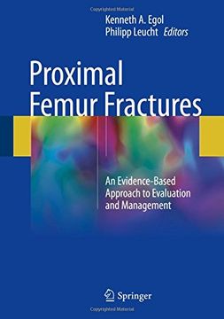 portada Proximal Femur Fractures: An Evidence-Based Approach to Evaluation and Management (in English)