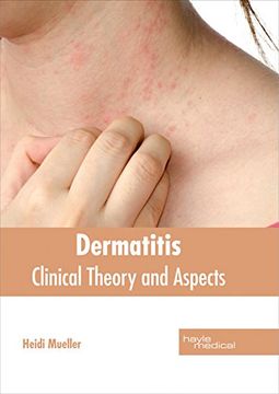 portada Dermatitis: Clinical Theory and Aspects (in English)