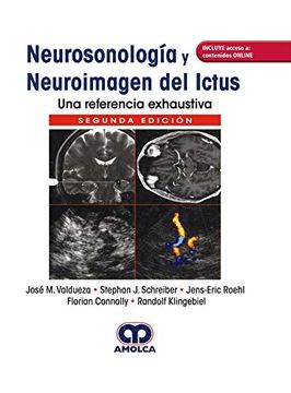 portada Neurosonología y Neuroimagen del Ictus