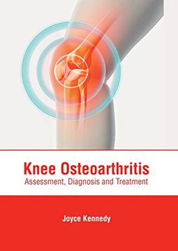 portada Knee Osteoarthritis: Assessment, Diagnosis and Treatment (in English)