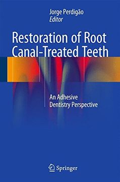 portada Restoration of Root Canal-Treated Teeth: An Adhesive Dentistry Perspective (en Inglés)